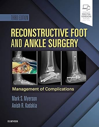 Reconstructive Foot and Ankle Surgery: Management of Complications : 3ed