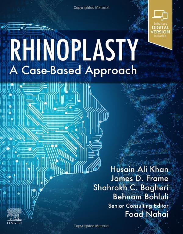 Rhinoplasty: a Case-based approach 1ed