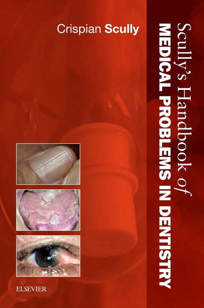 Scully's Handbook of Medical Problems in Dentistry: 1ed