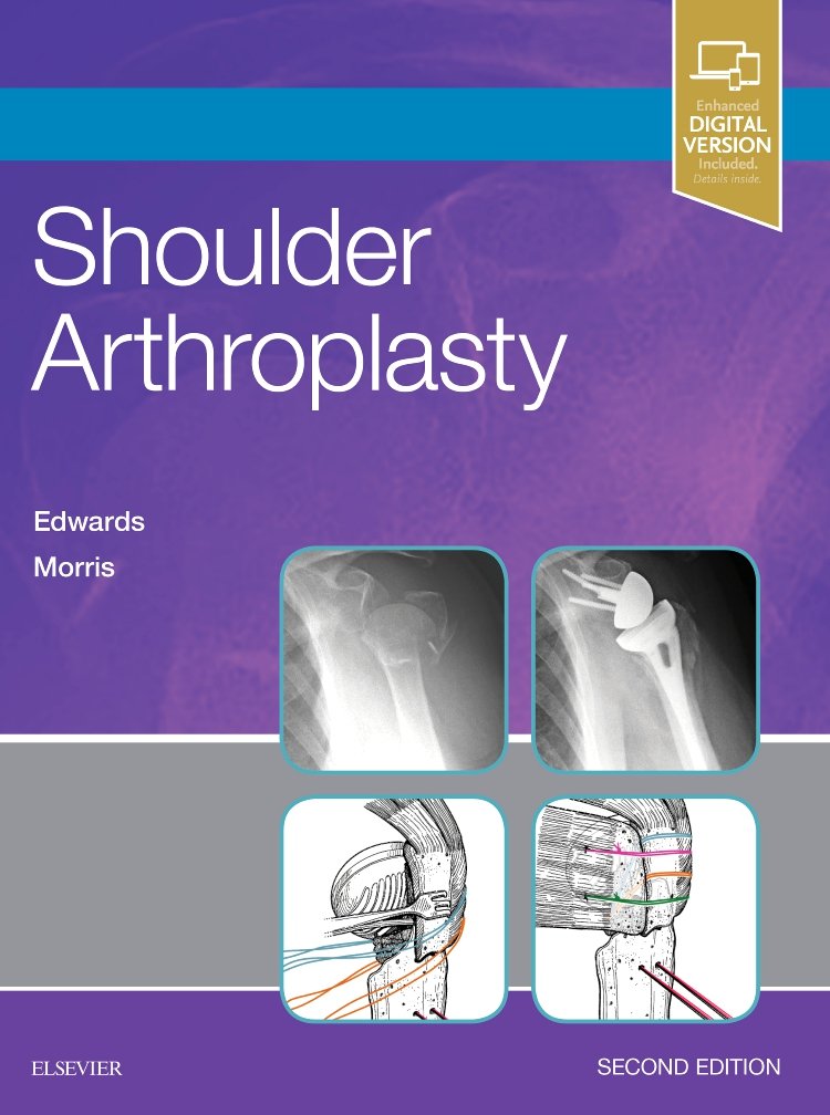 Shoulder Arthroplasty: 2ed