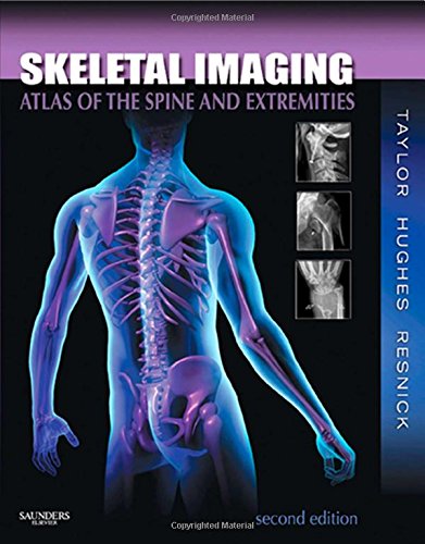 Skeletal Imaging: Atlas of the Spine and Extremities 2ed