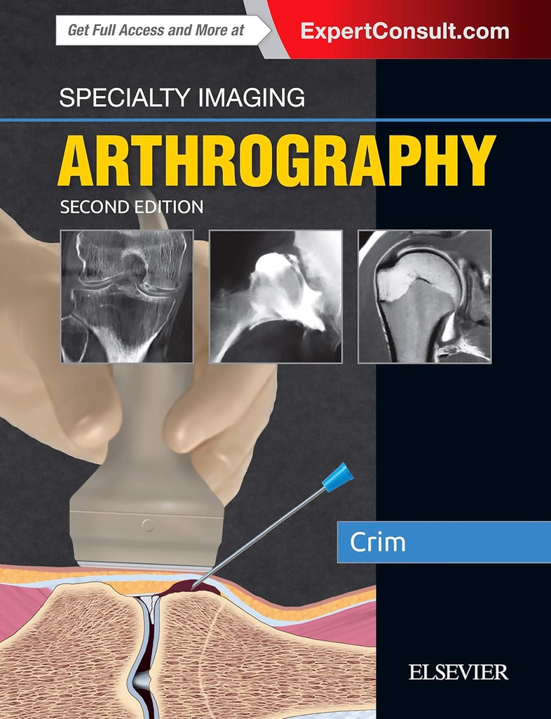 Specialty Imaging: Arthrography: 2ed