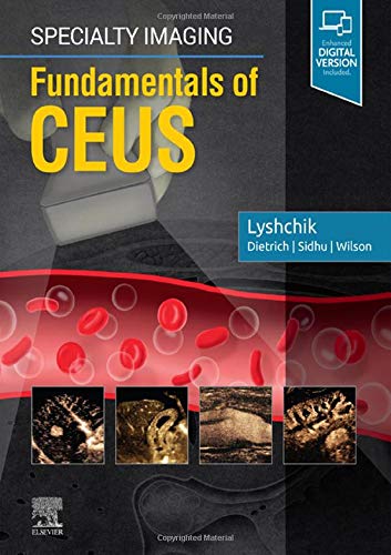 Specialty Imaging: Fundamentals of CEUS: 1ed