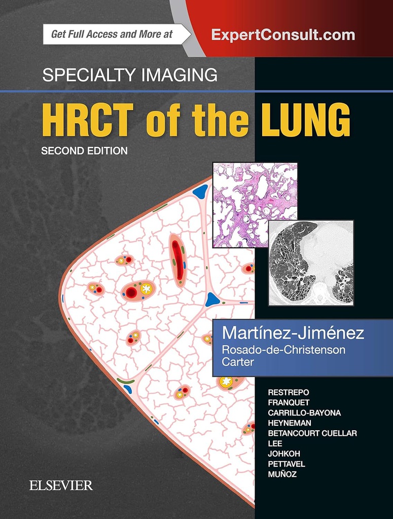 Specialty Imaging: HRCT of the Lung: 2ed