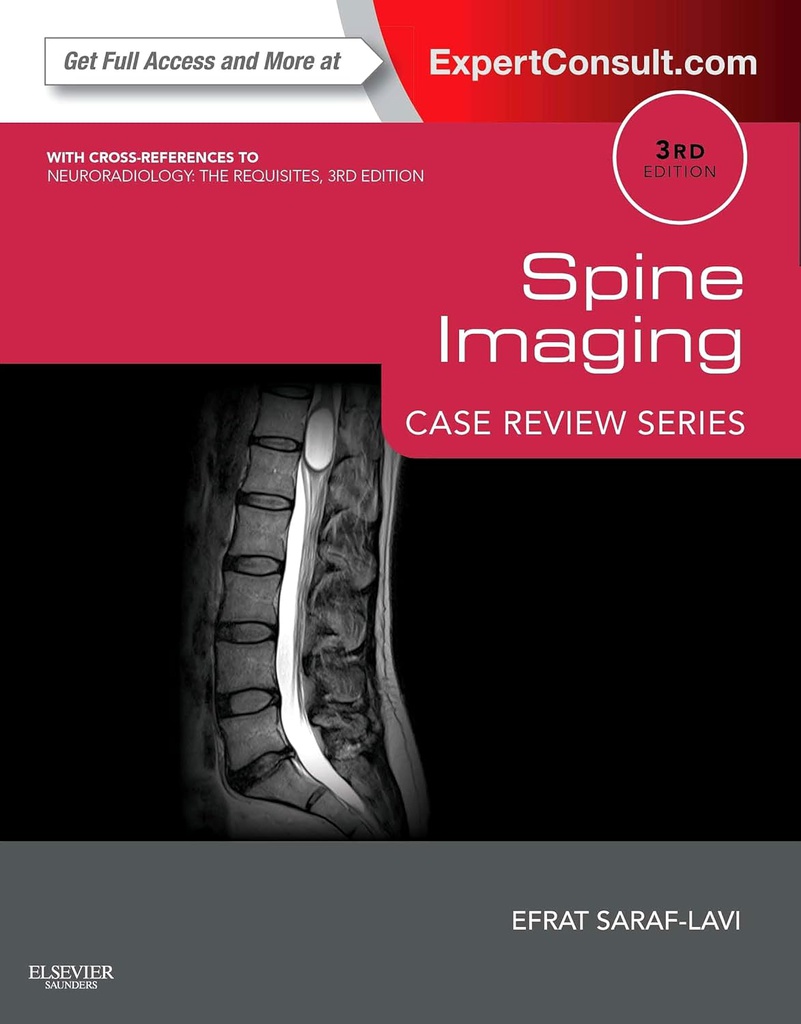 Spine Imaging: Case Review Series: Expert Consult - Online and Print 3ed