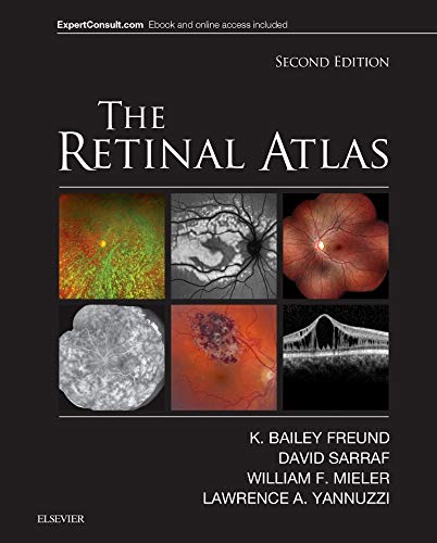 The Retinal Atlas: 2ed