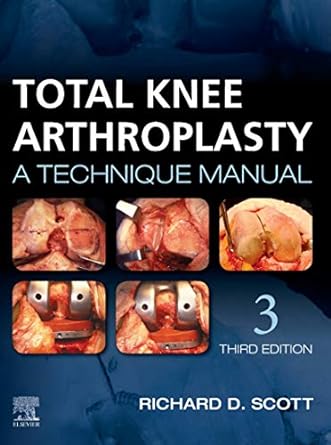 Total Knee Arthroplasty: A Technique Manual 3ed