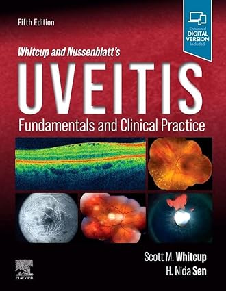 Whitcup and Nussenblatt's Uveitis: Fundamentals and Clinical Practice 5ed