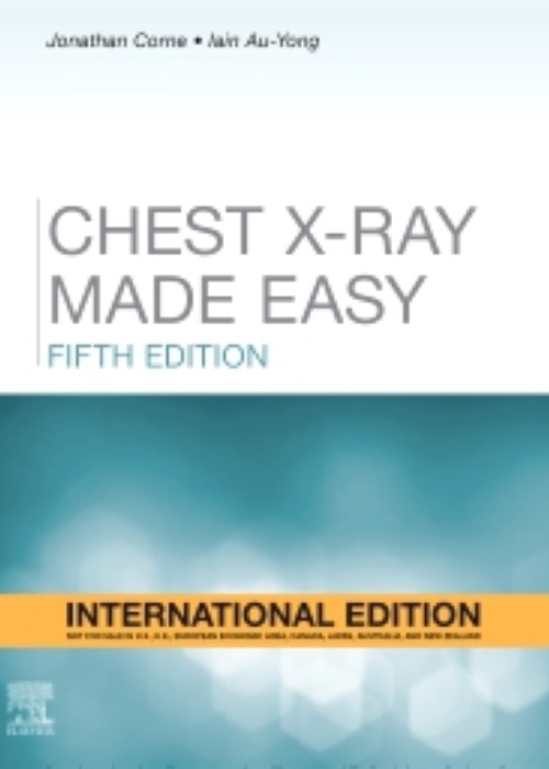 Chest X-Ray Made Easy, IE: 5ed