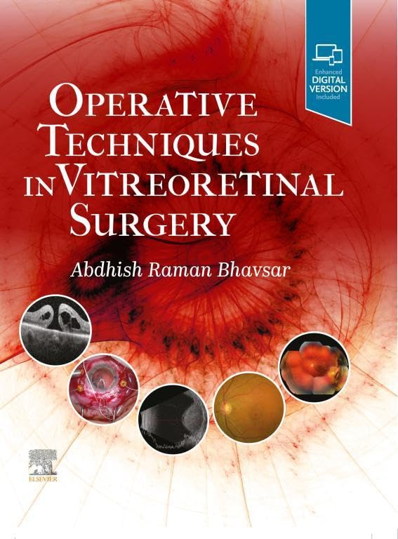 Operative Techniques in Vitreoretinal Surgery: 1ed