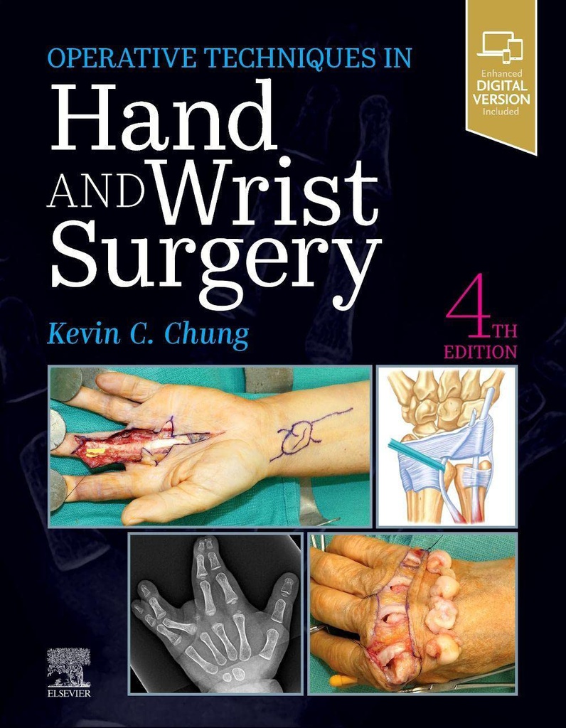 Operative Techniques: Hand and Wrist Surgery: 4ed