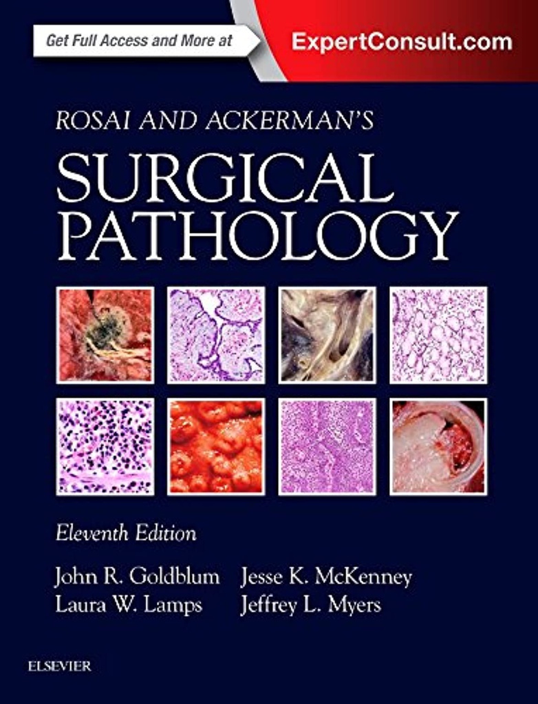 Rosai and Ackerman's Surgical Pathology - 2 VOL Set: 11ed