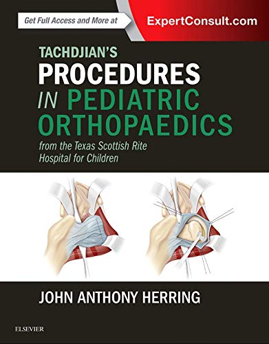 Tachdjian's Procedures in Pediatric Orthopaedics: From the Texas Scottish Rite Hospital for Children 1ed