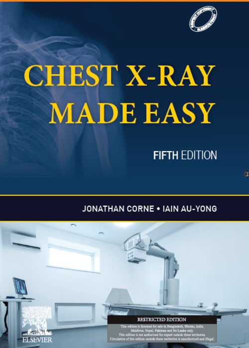 Chest X-Ray Made Easy, 5e