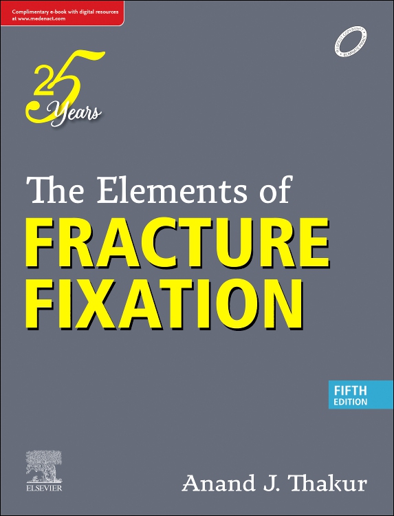 The Elements of Fracture Fixation, 5/e