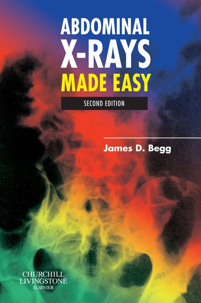 Abdominal X-Rays Made Easy: 2ed