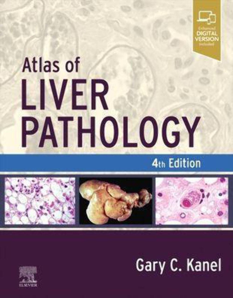 Atlas of Liver Pathology: 4ed