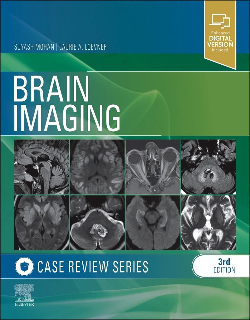 Brain Imaging: Case Review Series: 3ed