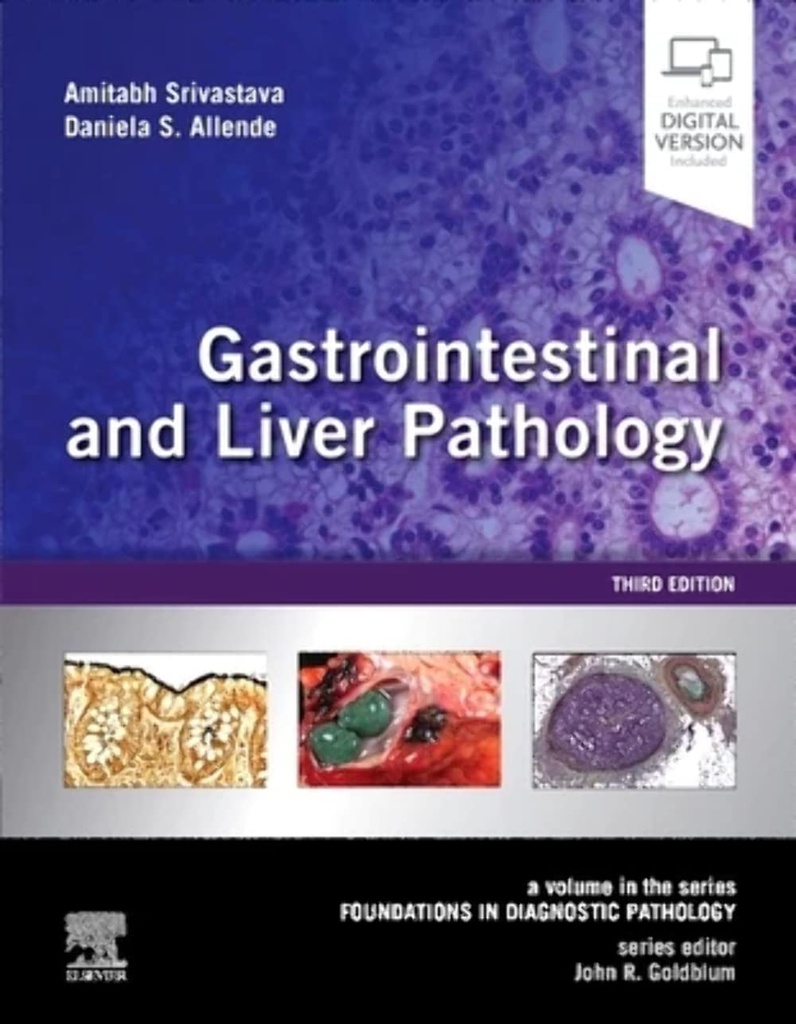 Gastrointestinal and Liver Pathology: A VOL in the Series: Foundations in Diagnostic Pathology 3ed