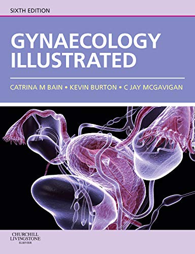 Gynaecology Illustrated: 6ed