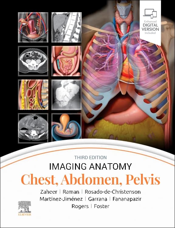 Imaging Anatomy: Chest, Abdomen, Pelvis: 3ed