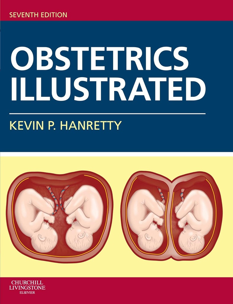 Obstetrics Illustrated: 7ed