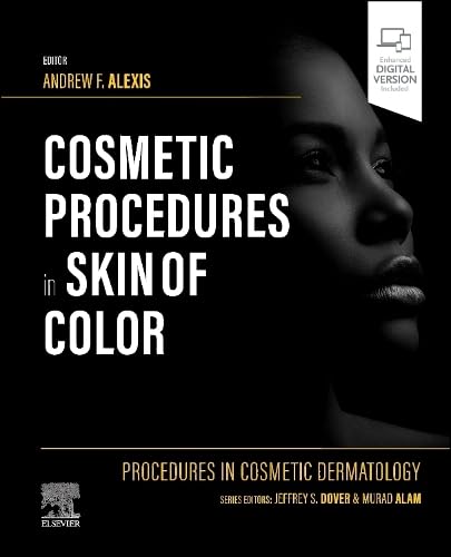 Procedures in Cosmetic Dermatology: Cosmetic Procedures in Skin of Color: 1ed