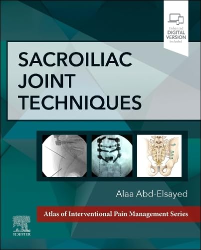 Sacroiliac Joint Techniques: 1ed