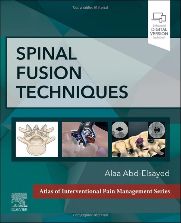 Spinal Fusion Techniques: 1ed