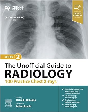 The Unofficial Guide to Radiology: 100 Practice Chest X Rays: 2ed