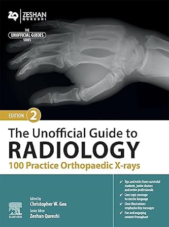 The Unofficial Guide to Radiology: 100 Practice Orthopaedic X Rays: 3ed