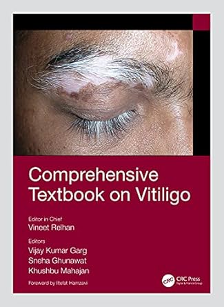 Comprehensive Textbook on Vitiligo