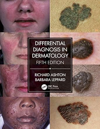 Differential Diagnosis in Dermatology, 5/e