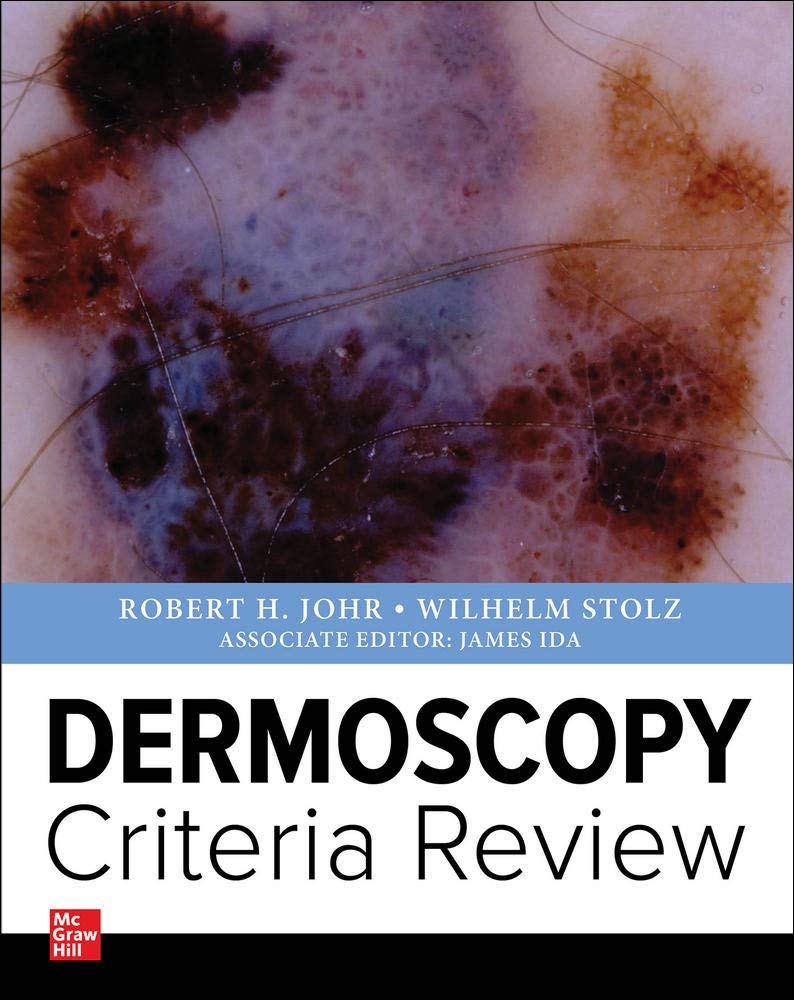 DERMOSCOPY CRITERIA REVIEW