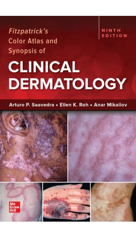 FITZPATRICK'S COLOR ATLAS & SYNOPSIS OF CLINICAL DERMA (IE)