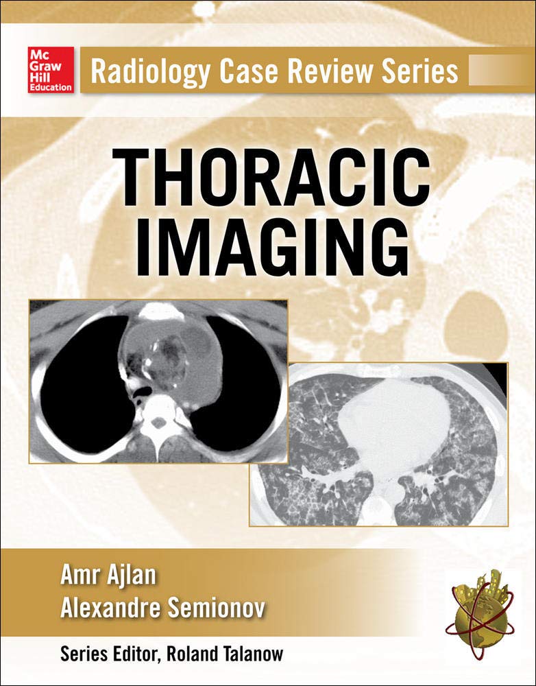 RADIOLOGY CASE REVIEW SRS: THORACIC IMAGING