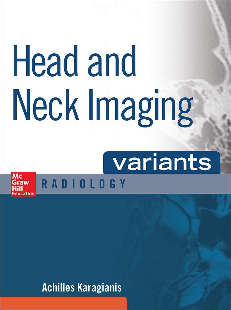 VARIANTS HEAD AND NECK IMAGING