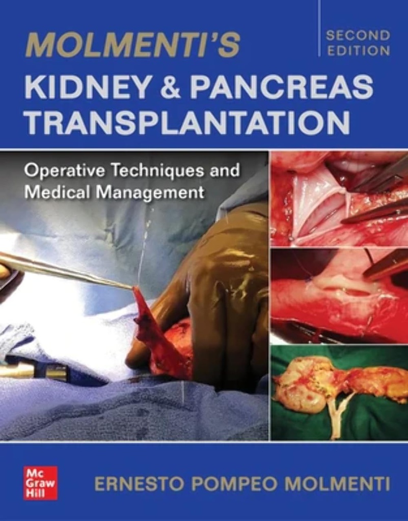 KIDNEY AND PANCREAS TRANSPLANTATION 2E