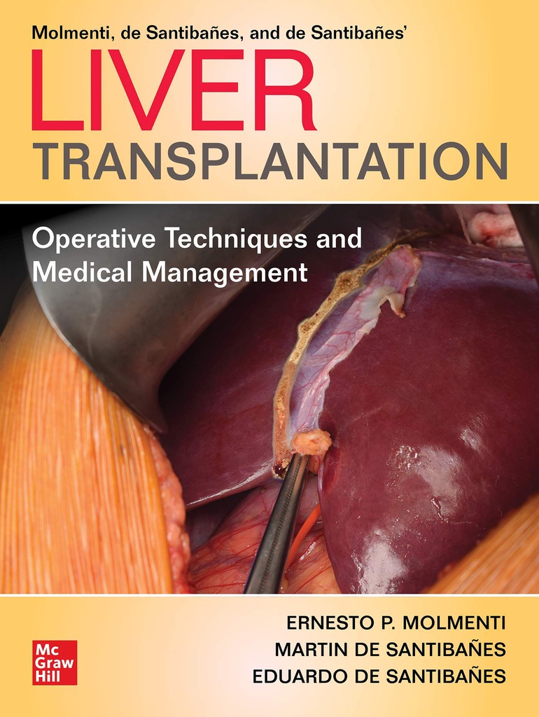 LIVER TRANSPLANTATION (MH SURGICAL SPECIALTY SERIES)