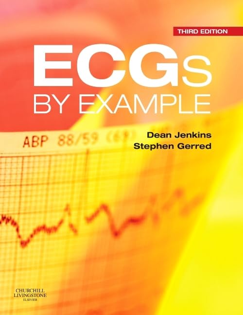 ECGs by Example: 3ed