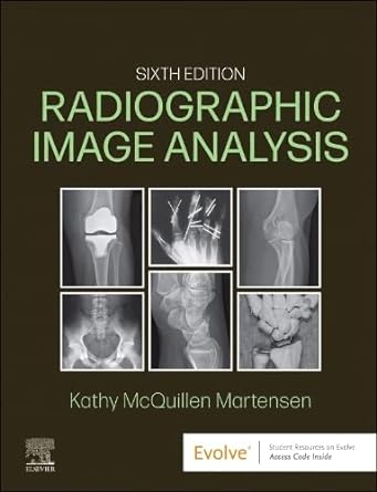 Radiographic Image Analysis: 6ed