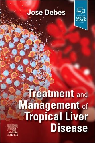 Treatment and Management of Tropical Liver Disease: 1ed