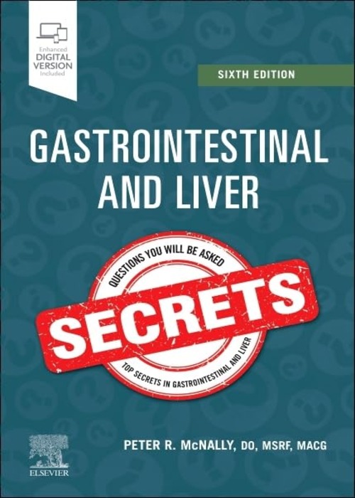 Gastrointestinal and Liver Secrets: 6ed