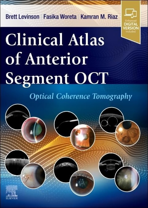 Clinical Atlas of Anterior Segment OCT: Optical Coherence Tomography: 1ed