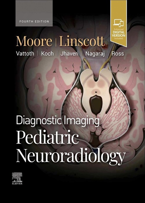 Diagnostic Imaging: Pediatric Neuroradiology: 4ed