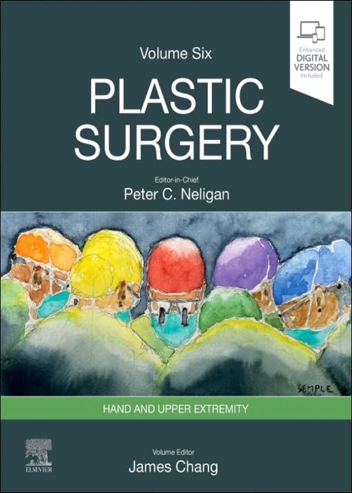 Plastic Surgery: Volume 6: Hand and Upper Limb 5ed