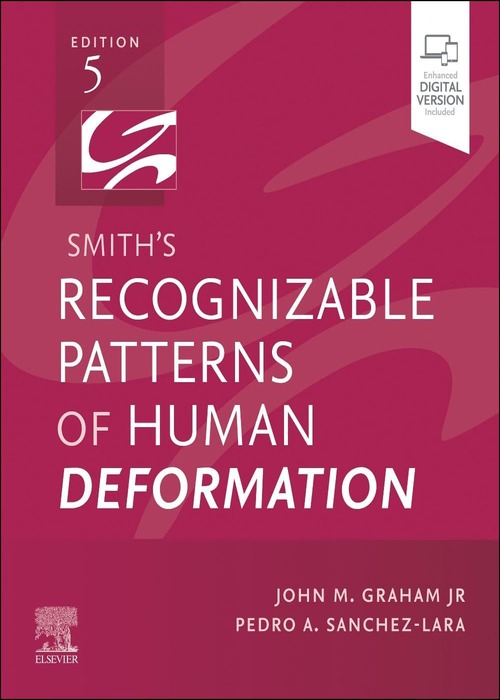 Smith's Recognizable Patterns of Human Deformation: 5ed