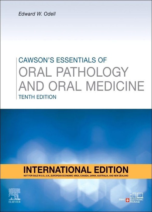 Cawson's Essentials of Oral Pathology and Oral Medicine, International Edition: 10ed