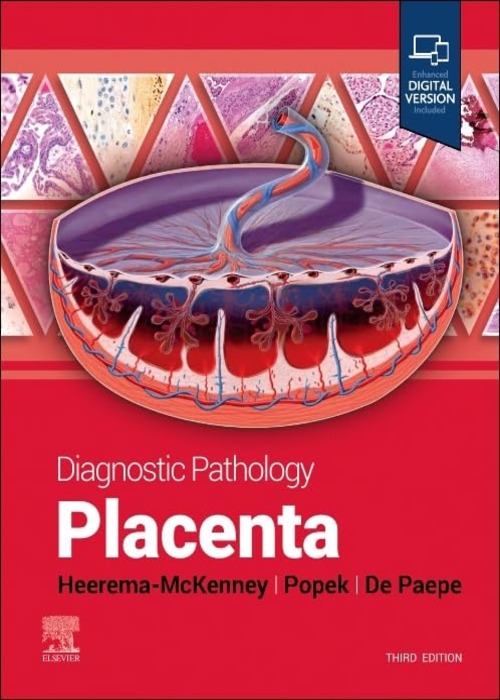 Diagnostic Pathology: Placenta: 3ed