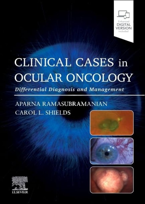 Clinical Cases in Ocular Oncology: Differential Diagnosis and Management 1ed